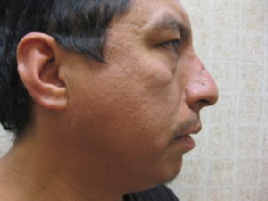 gal-img