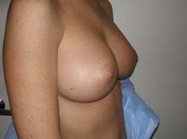 gal-img