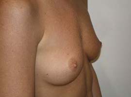 gal-img