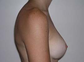 gal-img