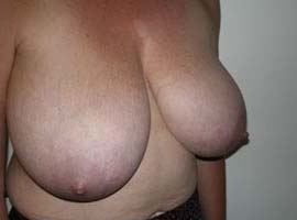 gal-img