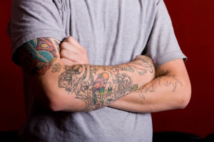 Tattoo Removal in Charleston, SC